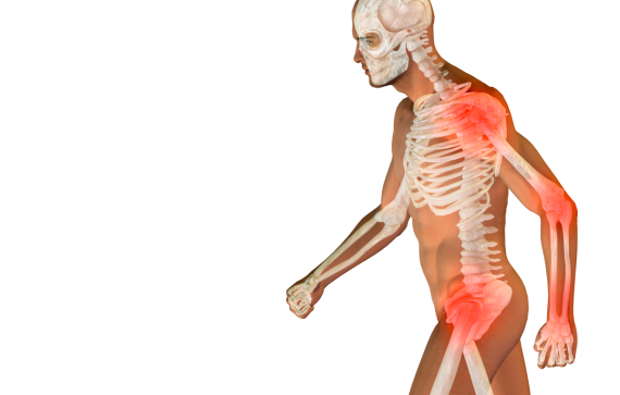 upn_salud_osteoporosis